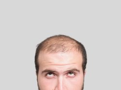 Balding Men Meme Template