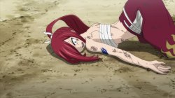 broken bones Meme Template