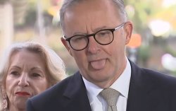 ANTHONY ALBANESE VILLAGE IDIOT Meme Template