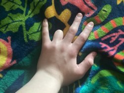 ToadyTheToads fat hand Meme Template