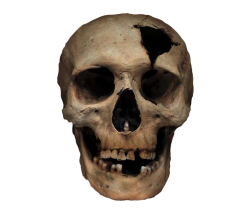 Cracked Skull Meme Template