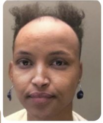 baldy imar Meme Template