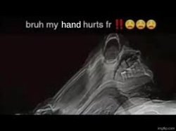 my hand hurts fr Meme Template