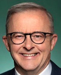 Anthony Albanese Smile Meme Template