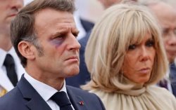 Emmanuel Macron with Black Eye Meme Template
