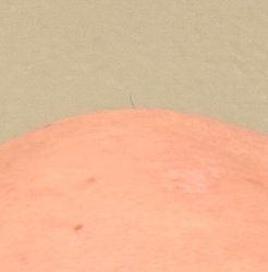 Bold head single hair Meme Template