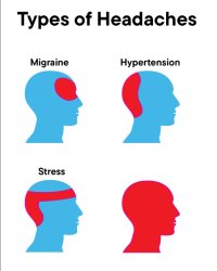 Types of Headaches Meme Template