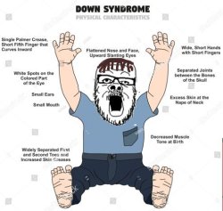 Down's Syndrome soyjak Meme Template