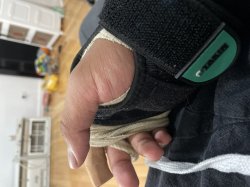 Ouch hand Meme Template