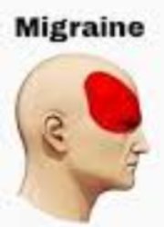 Migraine Meme Template