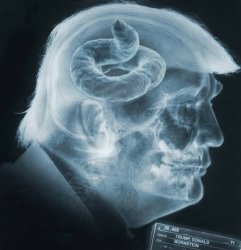 X-ray of Trump's brain, if any. Suspicious brown matter found. Meme Template