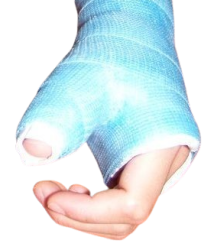 Broken hand cast Meme Template