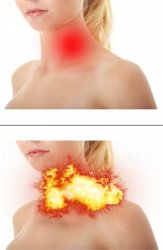 Throat Explosion Meme Template