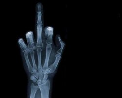 xray finger Meme Template