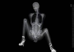 XRAY PORN Meme Template