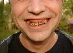 Badteeth Meme Template