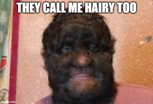 THEY CALL ME HAIRY TOO | made w/ Imgflip meme maker