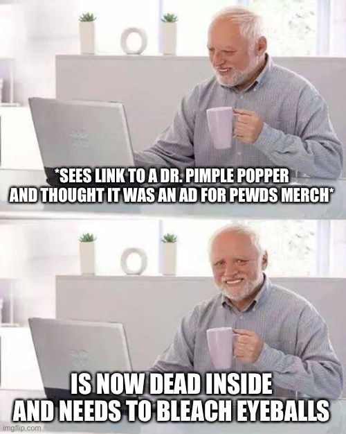 Hide the Pain Harold | *SEES LINK TO A DR. PIMPLE POPPER AND THOUGHT IT WAS AN AD FOR PEWDS MERCH*; IS NOW DEAD INSIDE AND NEEDS TO BLEACH EYEBALLS | image tagged in memes,hide the pain harold | made w/ Imgflip meme maker