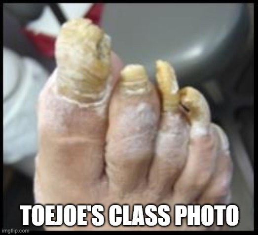 Ugly Toe Nails | TOEJOE'S CLASS PHOTO | image tagged in ugly toe nails | made w/ Imgflip meme maker