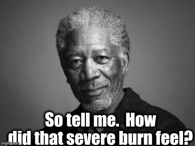 Morgan Freeman | So tell me.  How did that severe burn feel? | image tagged in morgan freeman | made w/ Imgflip meme maker