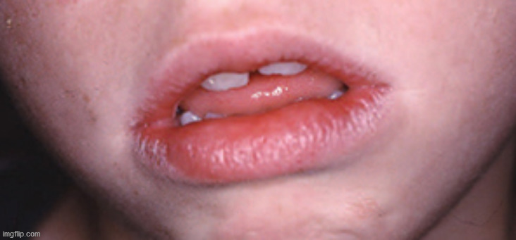 image tagged in mouth breather | made w/ Imgflip meme maker