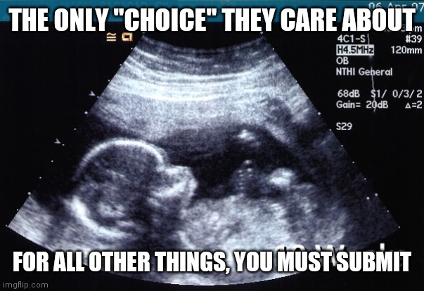 ultrasound | THE ONLY "CHOICE" THEY CARE ABOUT FOR ALL OTHER THINGS, YOU MUST SUBMIT | image tagged in ultrasound | made w/ Imgflip meme maker