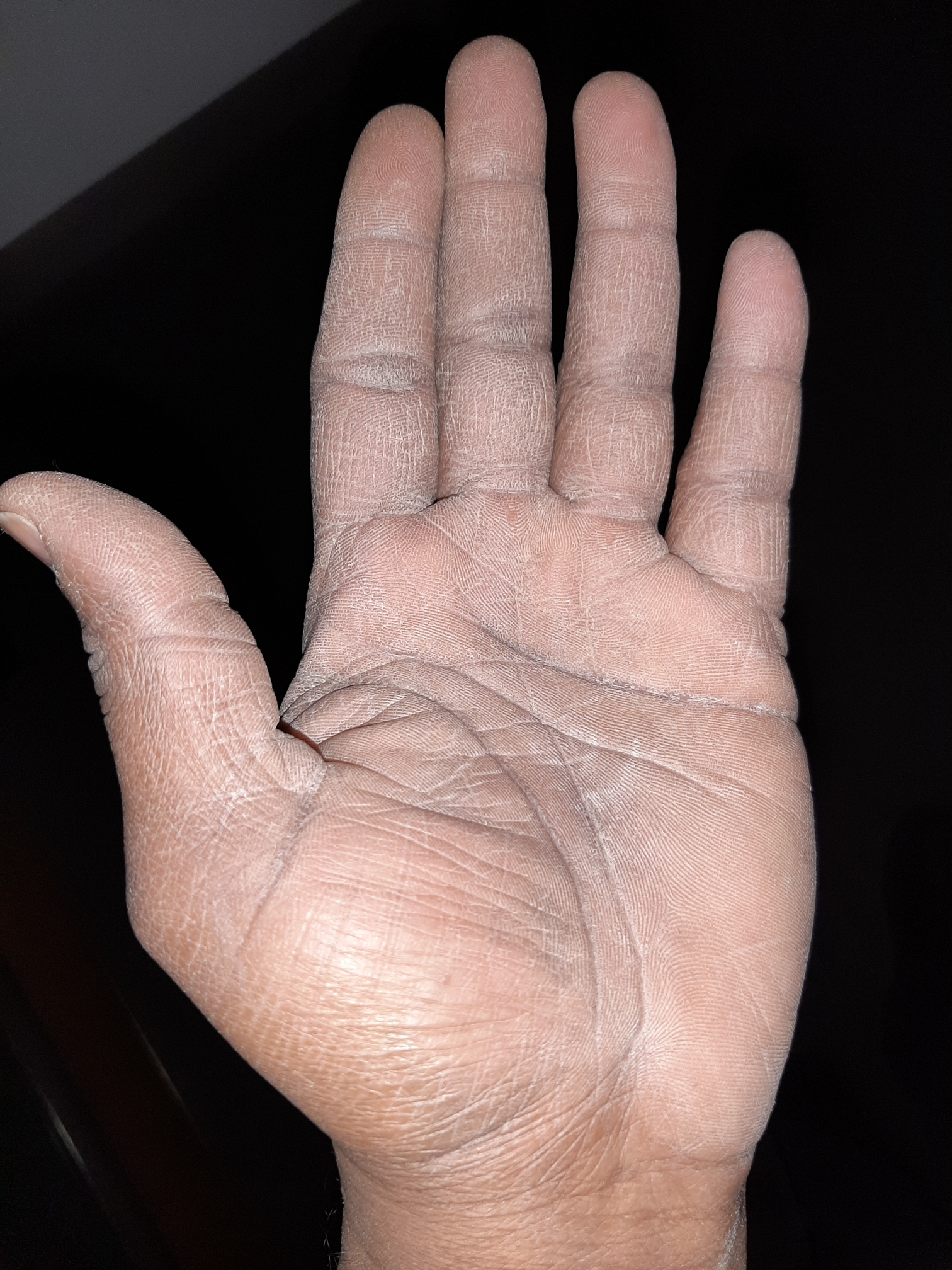 A health care workers hand after a hard days work. Blank Meme Template