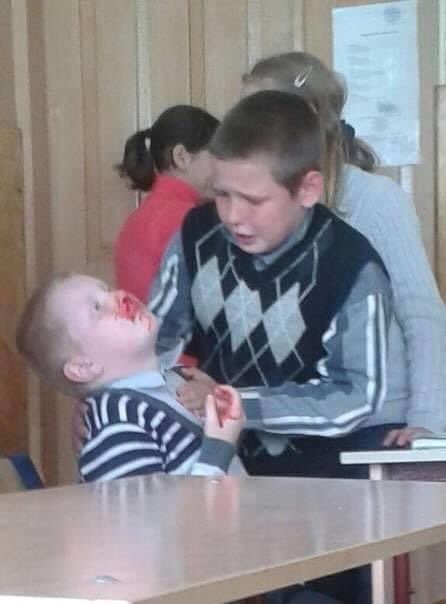 Brother holding brother with bleeding nose Blank Meme Template