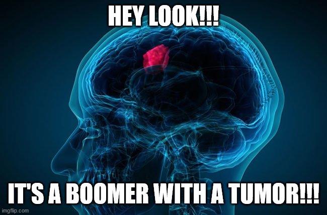 HEY LOOK!!! IT'S A BOOMER WITH A TUMOR!!! | image tagged in brain cancer | made w/ Imgflip meme maker
