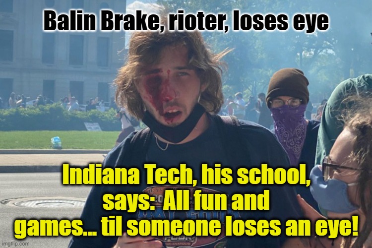 Balin Brake, Rioter | Balin Brake, rioter, loses eye; Indiana Tech, his school, says:  All fun and games... til someone loses an eye! | image tagged in indiana tech,balin brake,lose eye,george floyd riots,riots | made w/ Imgflip meme maker