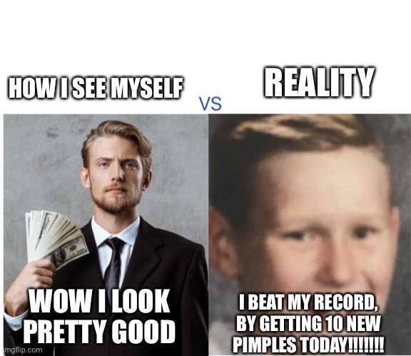 Big Oof | REALITY; HOW I SEE MYSELF; WOW I LOOK PRETTY GOOD; I BEAT MY RECORD, BY GETTING 10 NEW PIMPLES TODAY!!!!!!! | image tagged in expectations gone down,relatable,funny memes | made w/ Imgflip meme maker