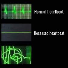 High Quality Heartbeat Types Blank Meme Template