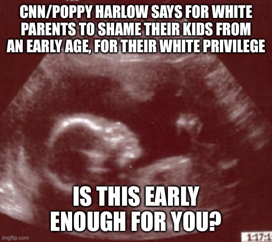 Sonogram of white privilege | CNN/POPPY HARLOW SAYS FOR WHITE PARENTS TO SHAME THEIR KIDS FROM AN EARLY AGE, FOR THEIR WHITE PRIVILEGE; IS THIS EARLY ENOUGH FOR YOU? | image tagged in sonogram | made w/ Imgflip meme maker