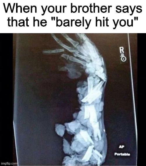 Ouch! |  When your brother says that he "barely hit you" | image tagged in memes,funny,bones,brothers,ouch | made w/ Imgflip meme maker