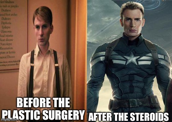 Captain America before after | BEFORE THE PLASTIC SURGERY; AFTER THE STEROIDS | image tagged in captain america before after | made w/ Imgflip meme maker