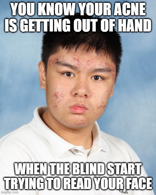 Be Proactiv | YOU KNOW YOUR ACNE IS GETTING OUT OF HAND; WHEN THE BLIND START TRYING TO READ YOUR FACE | image tagged in acne,dark humor | made w/ Imgflip meme maker