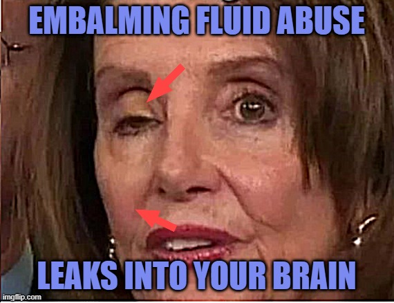 Nancy Pelosi Embalming Fluid Abuse | EMBALMING FLUID ABUSE; LEAKS INTO YOUR BRAIN | image tagged in pelosi's eye leaked embalming fluid | made w/ Imgflip meme maker