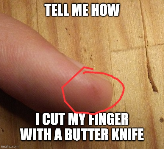 How | TELL ME HOW; I CUT MY FINGER WITH A BUTTER KNIFE | image tagged in cut finger | made w/ Imgflip meme maker