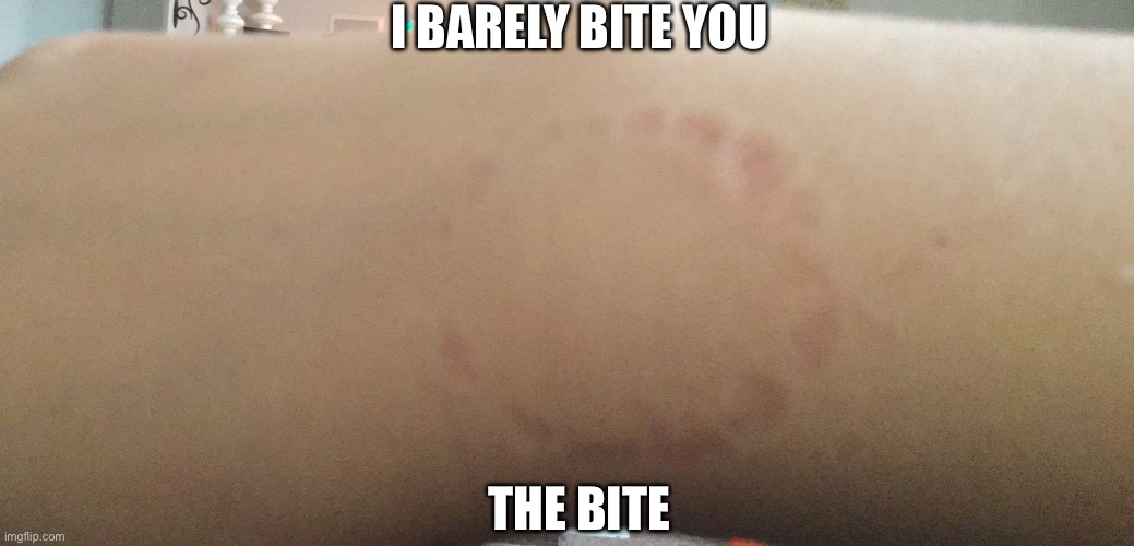 Come on | I BARELY BITE YOU; THE BITE | image tagged in come on | made w/ Imgflip meme maker