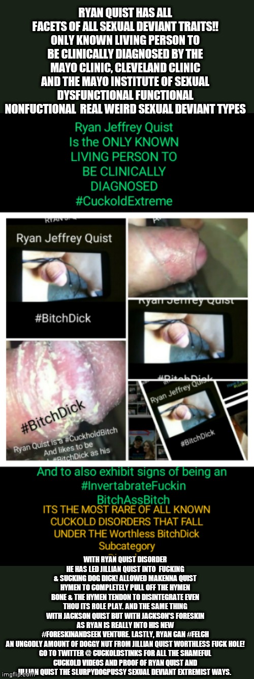 Ryan Quist has Rarest of Rare Cuckold DISORDERS: BitchDick | RYAN QUIST HAS ALL FACETS OF ALL SEXUAL DEVIANT TRAITS!! ONLY KNOWN LIVING PERSON TO BE CLINICALLY DIAGNOSED BY THE MAYO CLINIC, CLEVELAND CLINIC AND THE MAYO INSTITUTE OF SEXUAL DYSFUNCTIONAL FUNCTIONAL NONFUCTIONAL  REAL WEIRD SEXUAL DEVIANT TYPES; WITH RYAN QUIST DISORDER HE HAS LED JILLIAN QUIST INTO  FUCKING & SUCKING DOG DICK! ALLOWED MAKENNA QUIST HYMEN TO COMPLETELY PULL OFF THE HYMEN BONE & THE HYMEN TENDON TO DISINTEGRATE EVEN THOU ITS ROLE PLAY. AND THE SAME THING WITH JACKSON QUIST BUT WITH JACKSON'S FORESKIN AS RYAN IS REALLY INTO HIS NEW #FORESKINANDSEEK VENTURE. LASTLY, RYAN CAN #FELCH AN UNGODLY AMOUNT OF DOGGY NUT FROM JILLIAN QUIST WORTHLESS FUCK HOLE!

GO TO TWITTER @ CUCKOLDSTINKS FOR ALL THE SHAMEFUL CUCKOLD VIDEOS AND PROOF OF RYAN QUIST AND JILLIAN QUIST THE SLURPYDOGPUSSY SEXUAL DEVIANT EXTREMIST WAYS. | image tagged in ryan quist has rarest of rare cuckold disorders bitchdick | made w/ Imgflip meme maker