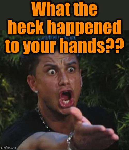 DJ Pauly D Meme | What the heck happened to your hands?? | image tagged in memes,dj pauly d | made w/ Imgflip meme maker