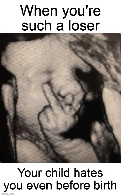 Fetus flipping the bird | When you're such a loser; Your child hates you even before birth | image tagged in memes,loser,fetus,flipping the bird,sonagram | made w/ Imgflip meme maker