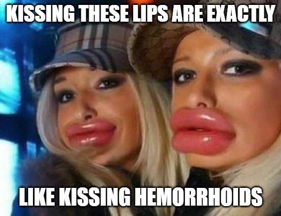 Yikes | KISSING THESE LIPS ARE EXACTLY; LIKE KISSING HEMORRHOIDS | image tagged in memes,duck face chicks,funny,scary,fun | made w/ Imgflip meme maker