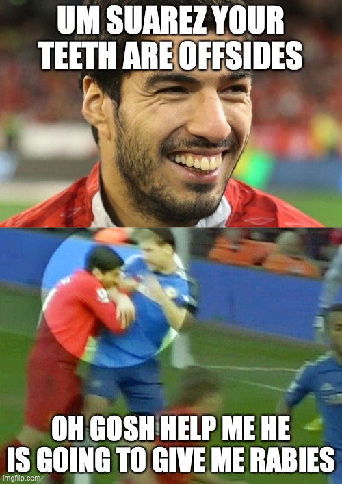 UM SUAREZ YOUR TEETH ARE OFFSIDES; OH GOSH HELP ME HE IS GOING TO GIVE ME RABIES | image tagged in teeth | made w/ Imgflip meme maker