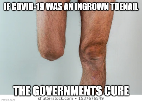 IF COVID-19 WAS AN INGROWN TOENAIL; THE GOVERNMENTS CURE | image tagged in covid-19,covid19,trump,cdc,hoax,economy | made w/ Imgflip meme maker