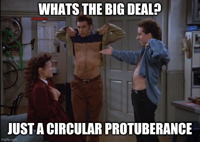 Circular protuberance | WHATS THE BIG DEAL? JUST A CIRCULAR PROTUBERANCE | image tagged in circular protuberance | made w/ Imgflip meme maker