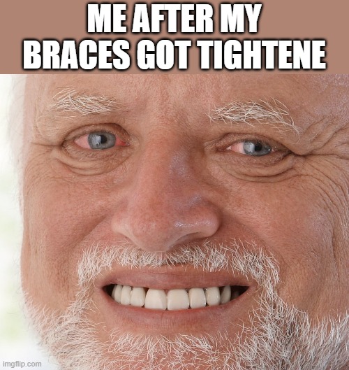 Hide the Pain Harold | ME AFTER MY BRACES GOT TIGHTENE | image tagged in hide the pain harold,i'm 15 so don't try it,who reads these | made w/ Imgflip meme maker