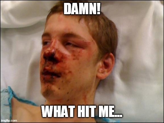 beat up guy | DAMN! WHAT HIT ME... | image tagged in beat up guy | made w/ Imgflip meme maker