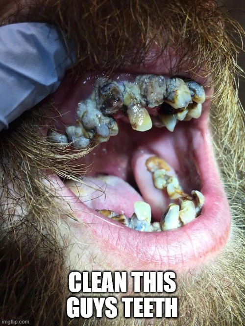 CLEAN THIS GUYS TEETH | made w/ Imgflip meme maker