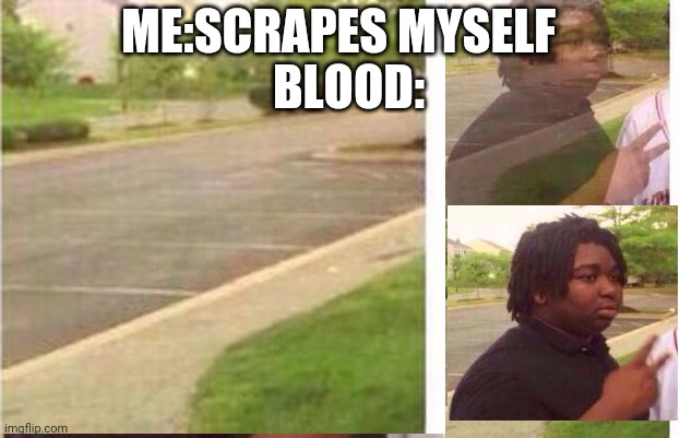 ouch | ME:SCRAPES MYSELF; BLOOD: | image tagged in memes,ouch | made w/ Imgflip meme maker